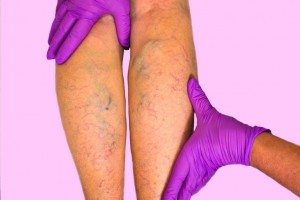 vaxrices.jpg_748993406