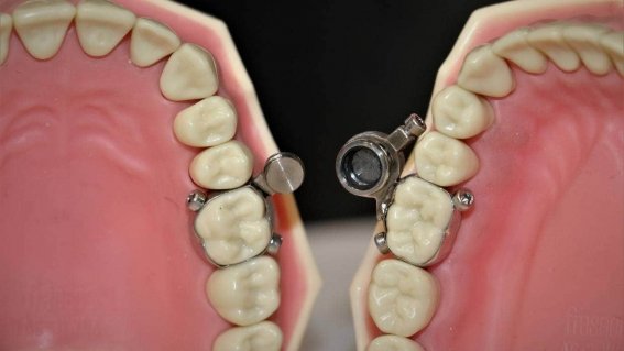 dentalslim