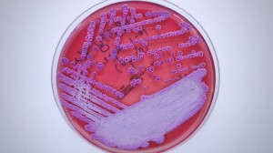 Bacterias - El Financiero