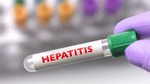 Hepatitis - Infobae