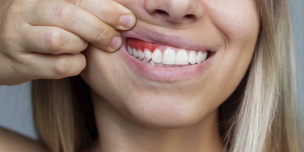 Encias dientes - Clinica dental sorias