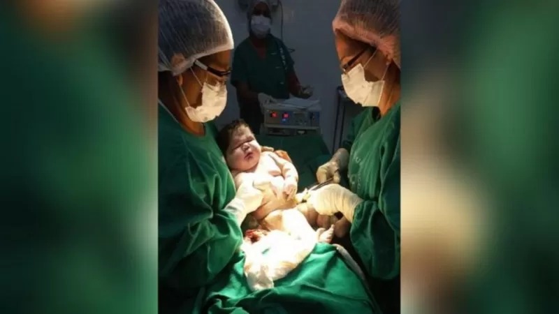 Bebe 7kg - bbc