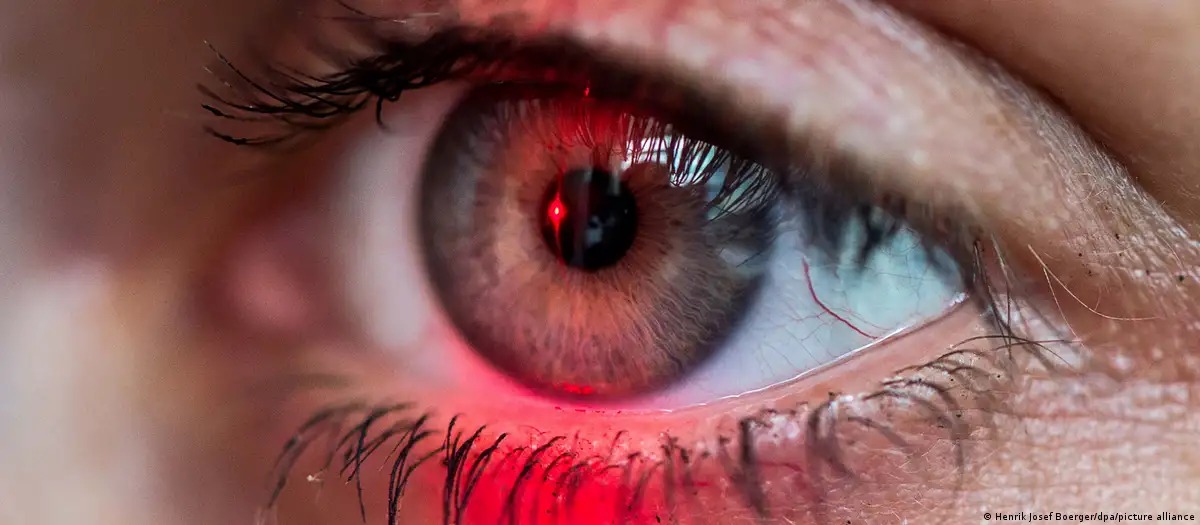 Ojo Iris - dw