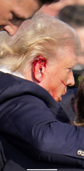 La Oreja de Don Trump