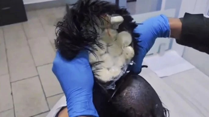 Droga Peluca - Proceso