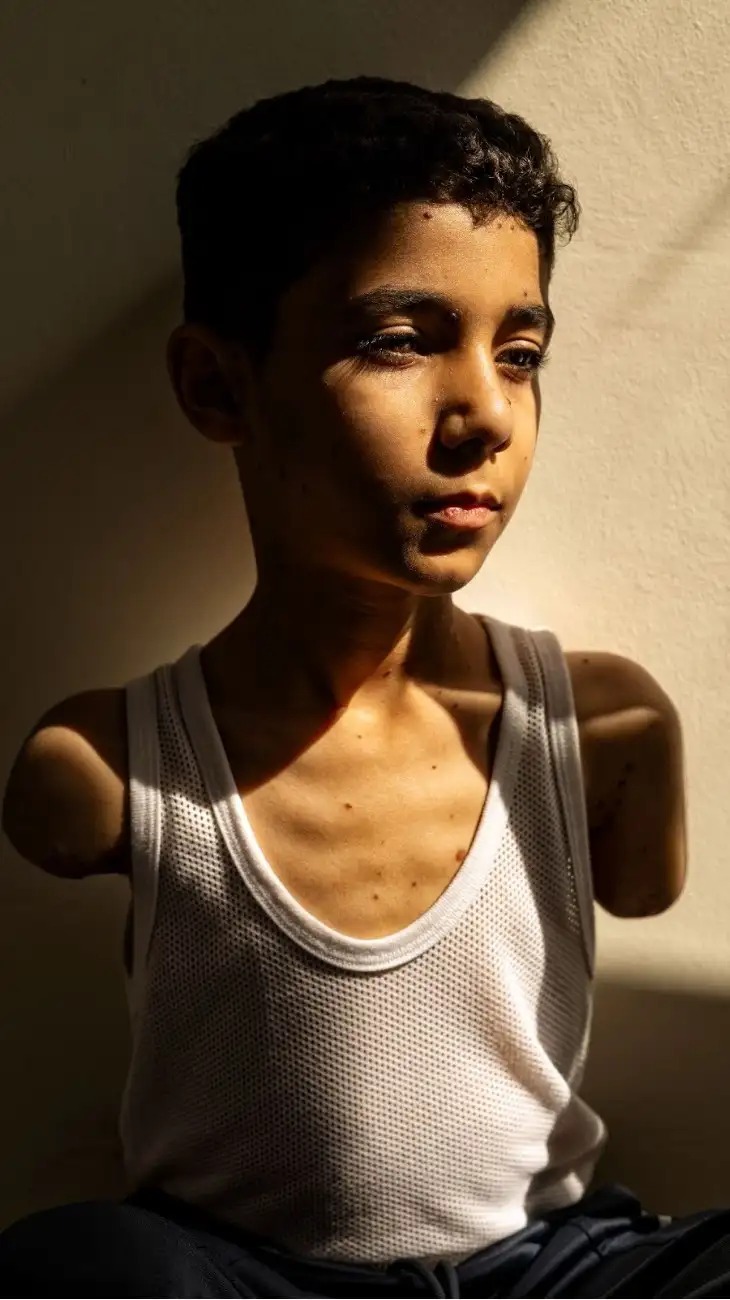 Niño mutilado gaza Perfil.com
